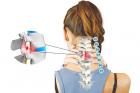 BIỆN PHÁP ĐIỀU TRỊ BỆNH THOÁI HÓA ĐỐT SỐNG CỔ KHỎI LÂU DÀI