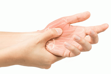Viêm Khớp Ngón Tay Biến Chứng Nguy Hiểm Nếu Không Điều Trị Kịp Thời