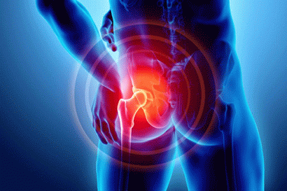 Cách Chữa Đau Khớp Háng Hiệu Quả